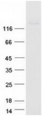 Coomassie blue staining of purified NCAM1 protein.
